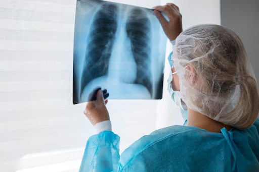 Doctor examining a lung X-ray